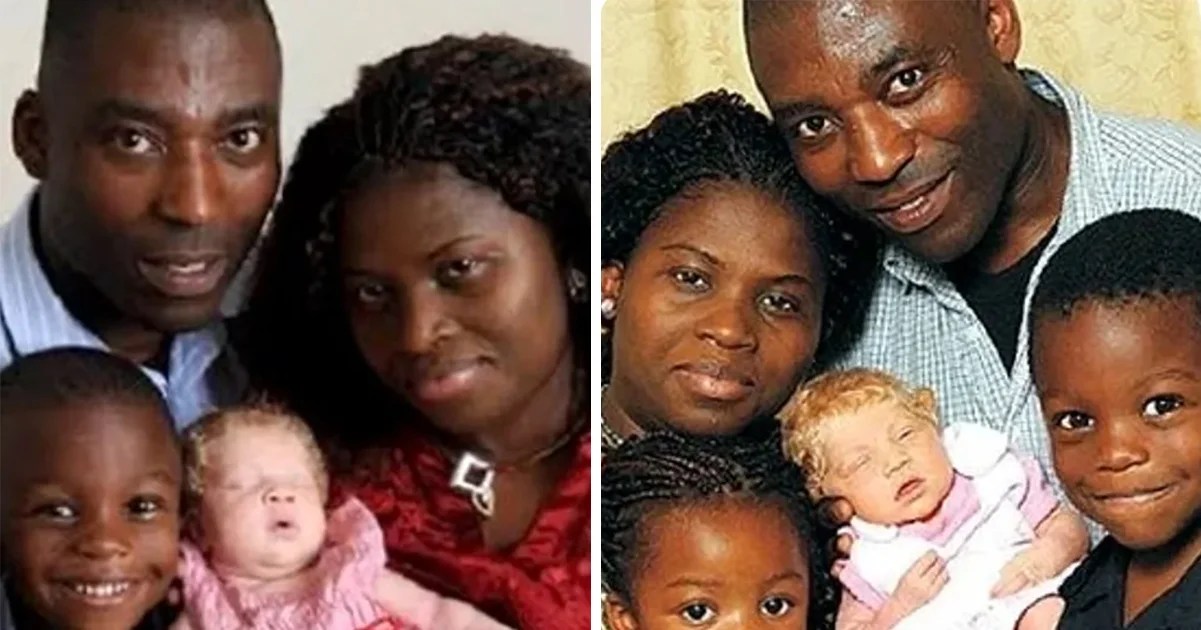 Black couple gives birth to blonde, blue-eyed child who they call "a miracle baby"