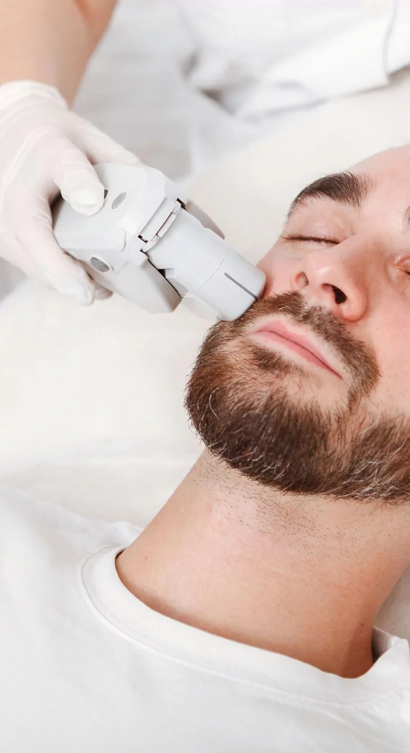 laser treatment