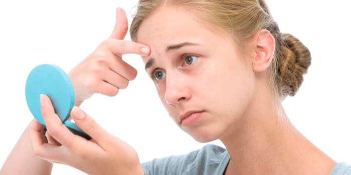 Подростковые прыщи — что делать? Подростковые прыщи: как с ними бороться? Почему в подростковом возрасте появляются прыщи