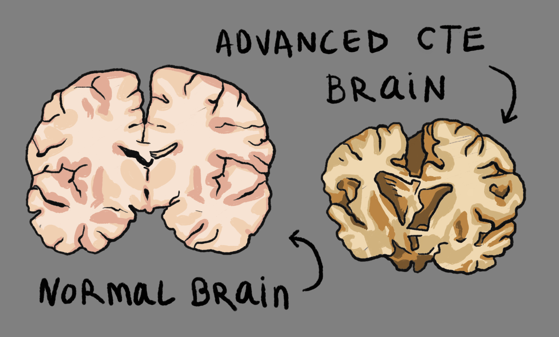 CTE