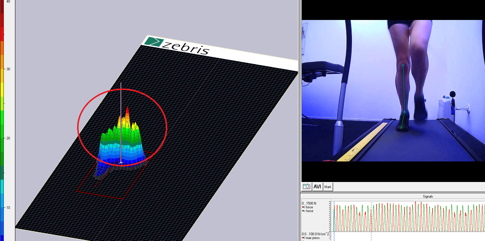 Forefoot Running + External Right Foot Rotation
