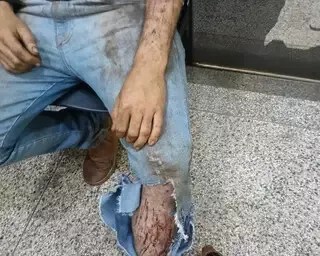 Jovem de 19 anos relata ataque de onça em colheitadeira em área rural de Ponta Porã