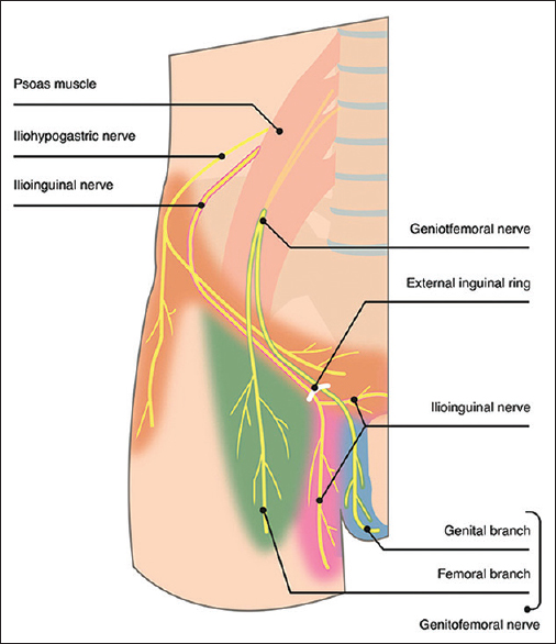 Describes the anatomy of the lateral femoral cutaneous nerve and interventional techniques for anesthesia and pain management. Pectineo Femoral Pinch Syndrome A Common Cause Of Groin Anterior Thigh Pain And Weakness Msk Neurology