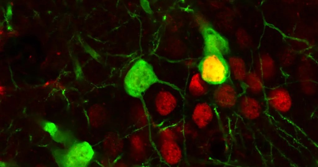 How Cocaine Rewires the Brain: What Drives Relapse (Explained with Science) (2026)