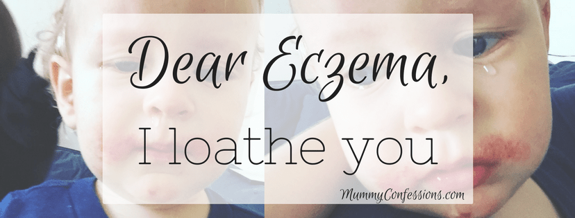 Dear Eczema, I loathe you