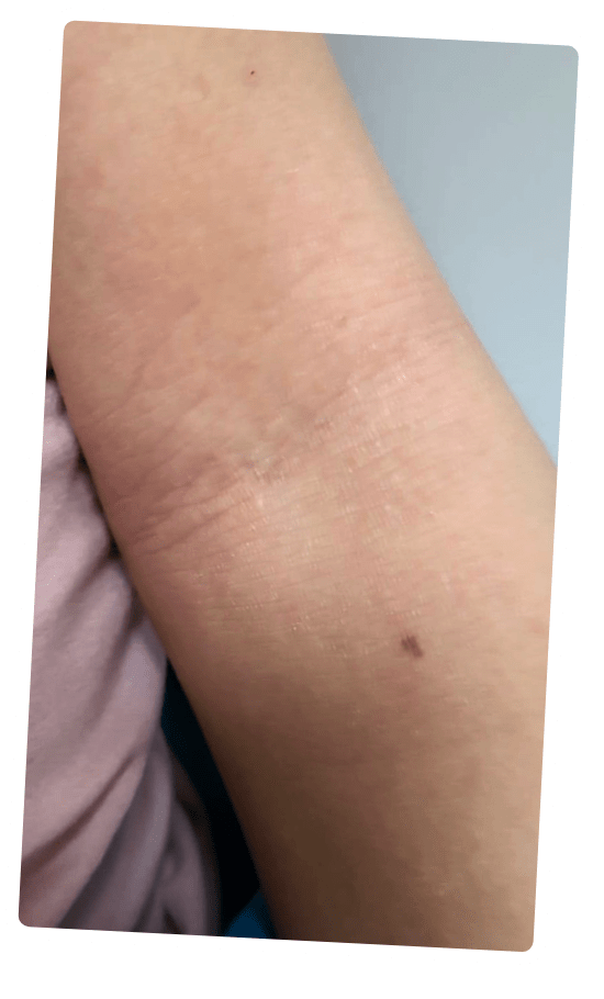 best skincare for dry skin uk