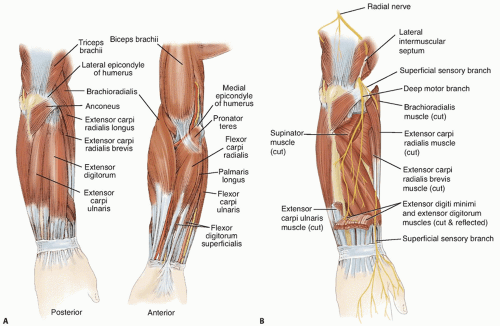 30.11.2021 · the triceps brachii muscle is the prime extensor of the forearm at the elbow joint, with assistance from the anconeus muscle, but is also capable of weak arm extension and adduction. Tendon Transfers For Radial Nerve Palsy Musculoskeletal Key