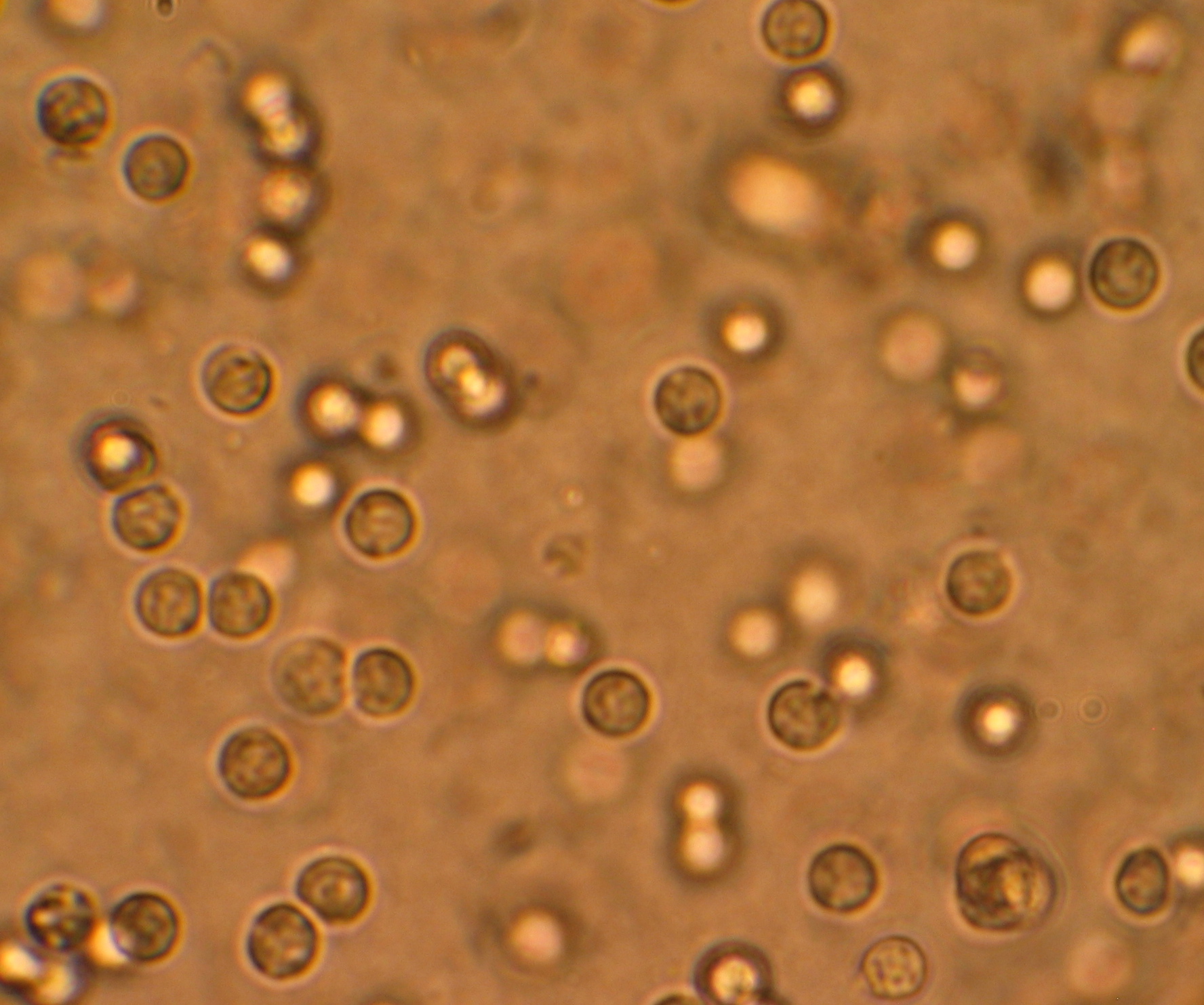 UTI