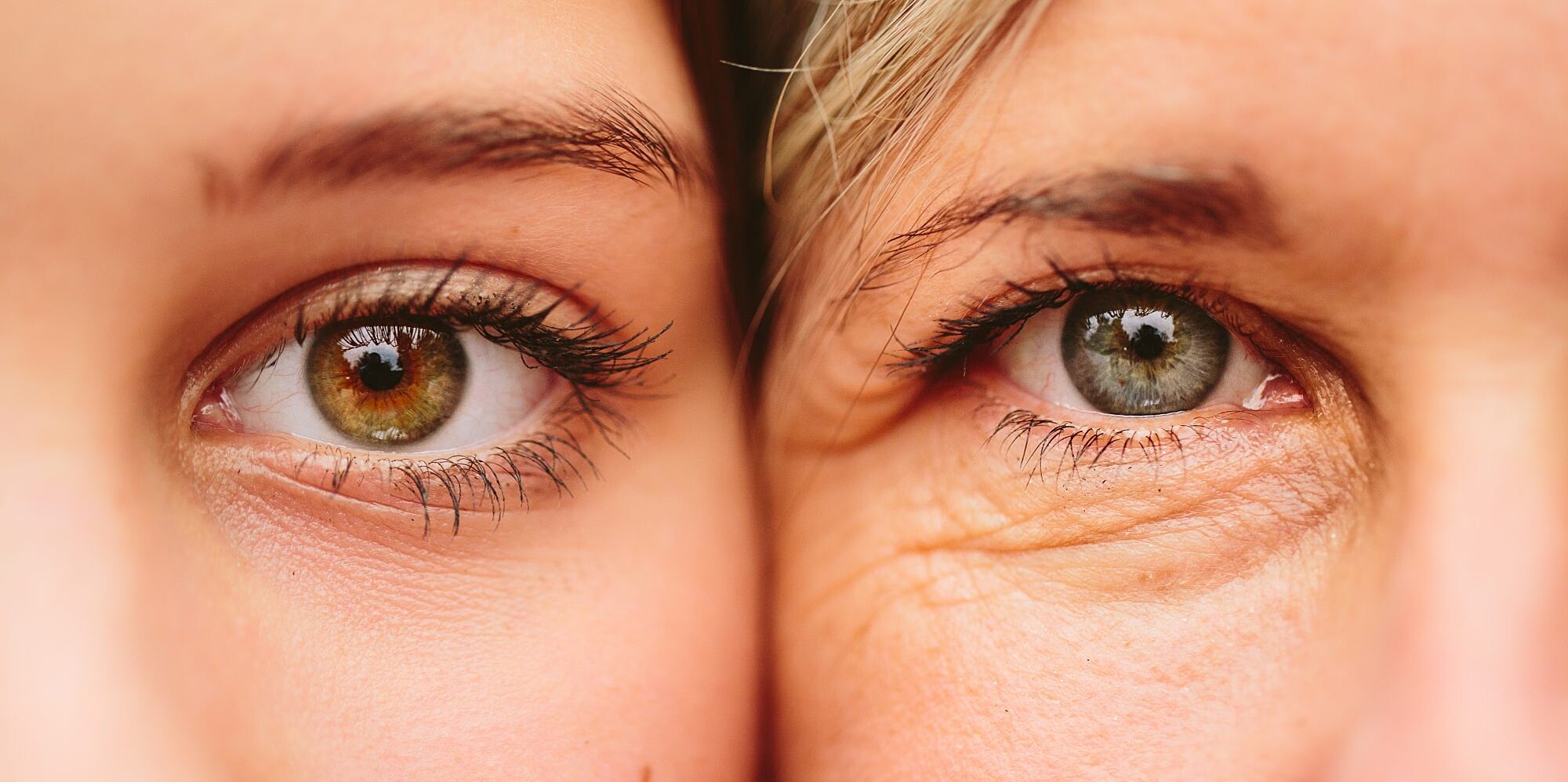 Endringer i huden med alderen