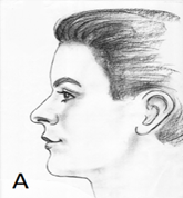Opened-mouth posture