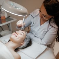 1 session of RF lifting