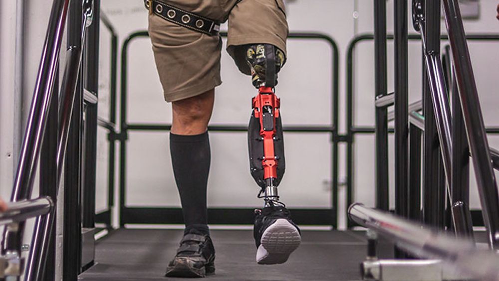 ITLA anuncia donará prótesis gratuitas para afectados en tragedia de Jet Set