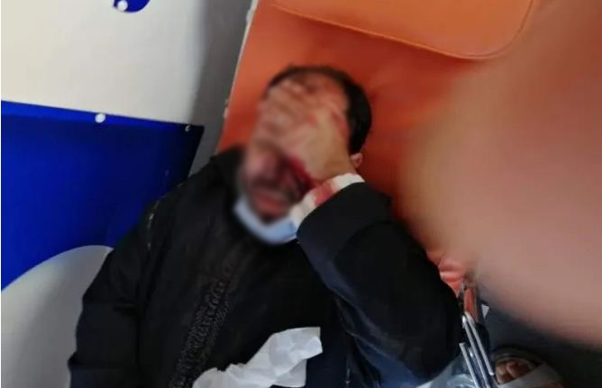 منتخبون “يشرملون” منافسهم بسبب انتخابات الغرف المهنية (صور)