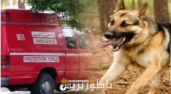 الناظور.. كلاب ضالة تهاجم شخصان وطفل قرب جامعة سلوان وتعجل بإرسالهم للمستعجلات