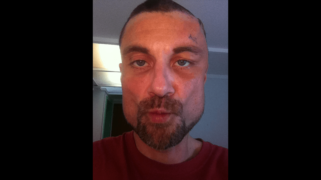 dent-head (after 3rd/final round of studies at Stanford)