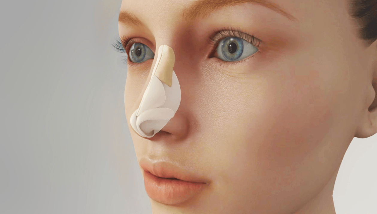 rhinoplasty plastic surgery medical animation moa device