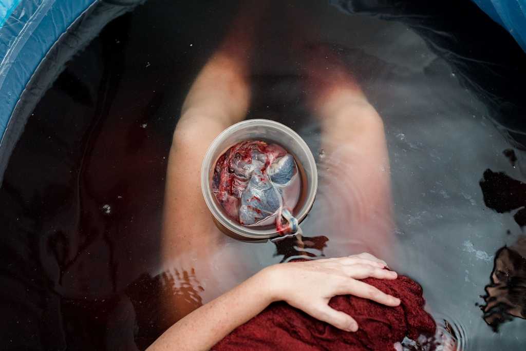 Comment honorer son placenta, cet organe incroyable que vous avez créé pendant neuf mois - Naturelle Maman