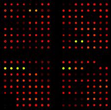 Array