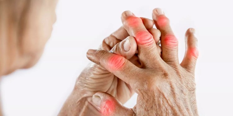 Inflammation