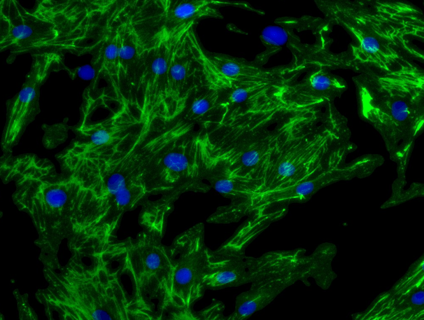 Nephrology cro Fibrosis assay