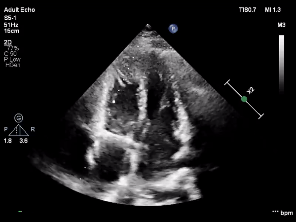 example-3 – NephroPOCUS