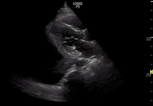 Whiteout Lung Nephropocus - Classic Space Image - Desktop