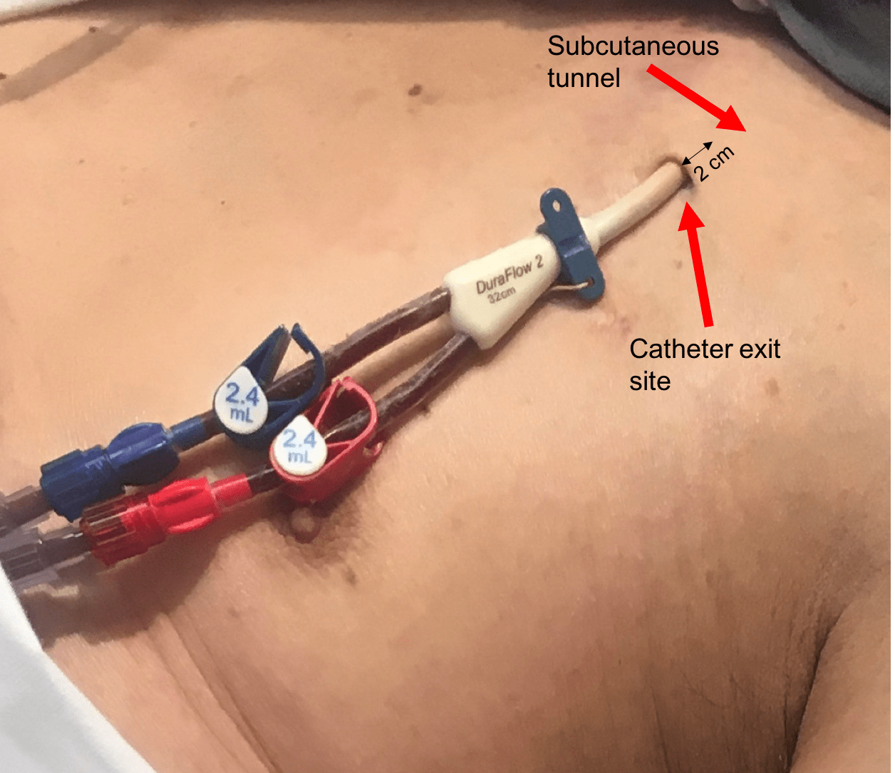Case 24 Diagnosis & Conclusions NephSIM