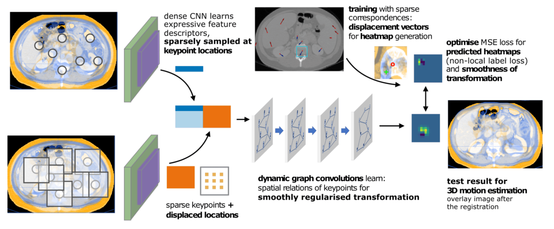 Generation of activation heatmaps for a CNN analyzing MRI data