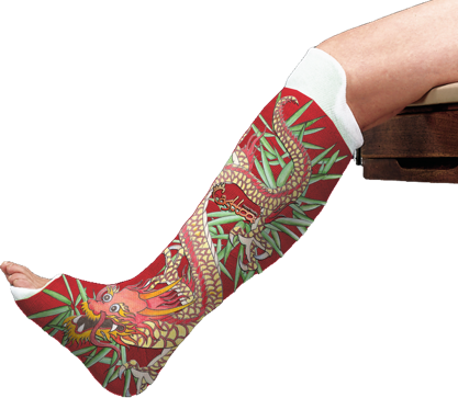 Casts, surgical; plaster casts; fiberglass casts; plastic casts