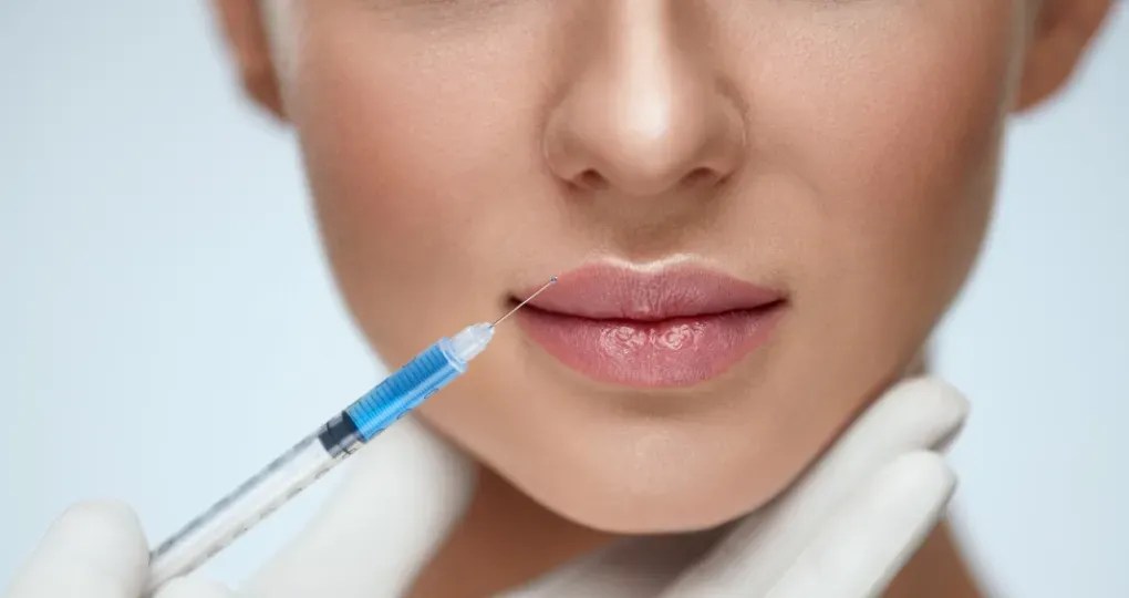 Modelowanie ust kwasem hialuronowym. Droga do pięknych i naturalnych konturów