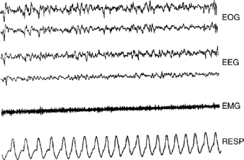 Sleep Disorders | Neupsy Key