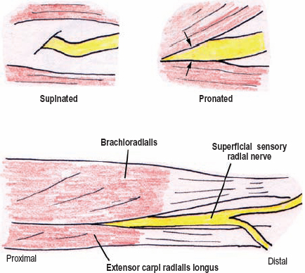 The radial nerve aids arm, wrist, hand and finger movements. The Diagnostic Anatomy Of The Radial Nerve Neupsy Key