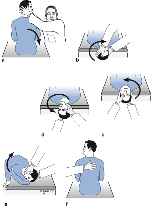 Disorders of the Vestibular System | Neupsy Key
