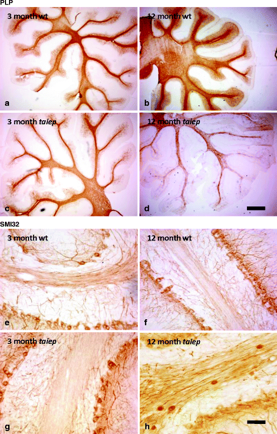 Mechanisms of Disease Progression | Neupsy Key