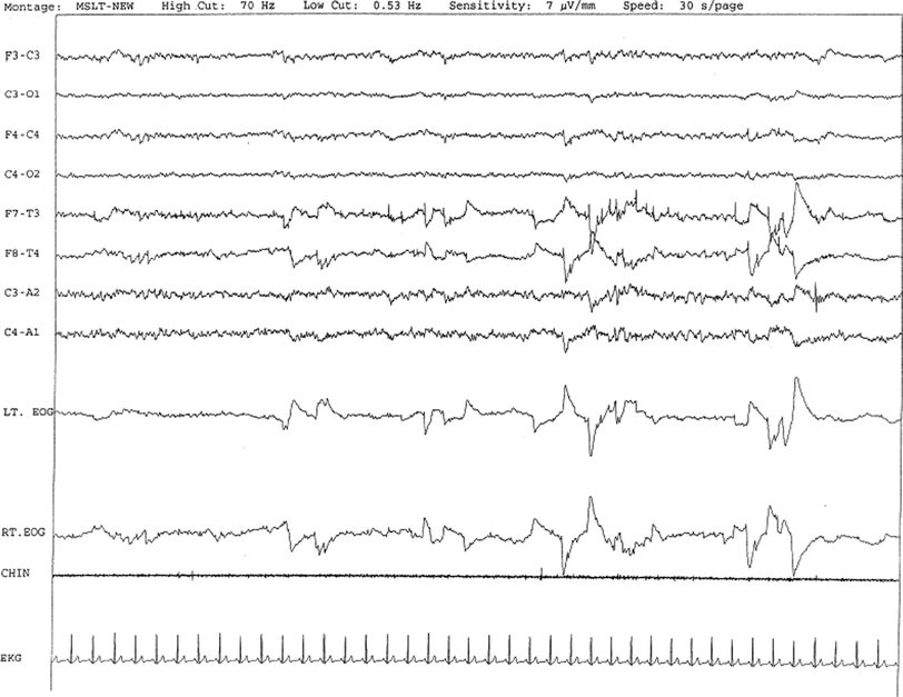 A309636_4_En_26_Fig4_HTML.gif