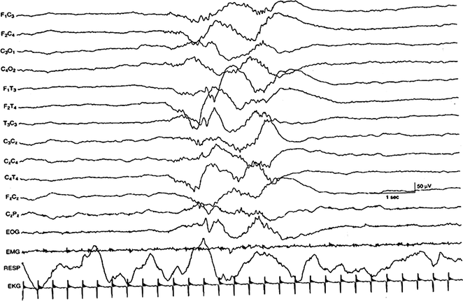 A313938_1_En_4_Fig2_HTML.gif