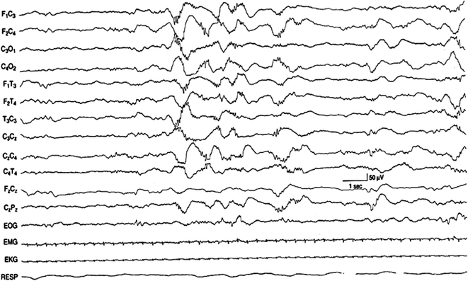 A313938_1_En_4_Fig7_HTML.gif