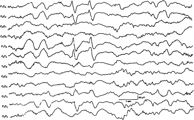 A313938_1_En_4_Fig8_HTML.gif