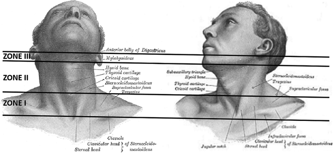 A326675_1_En_11_Fig2_HTML.gif