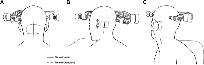 A371319_1_En_13_Fig6_HTML.gif