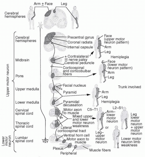 Historical Evaluation of Key Signs and Symptoms | Neupsy Key