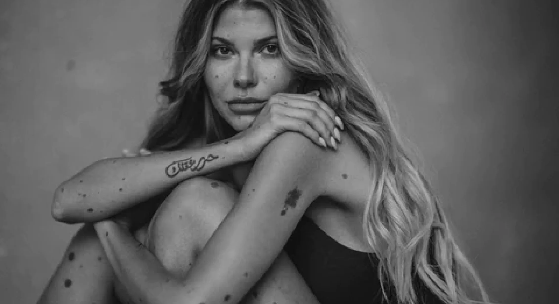 Your dermatoscope and doctor's office online in the Neviscope app