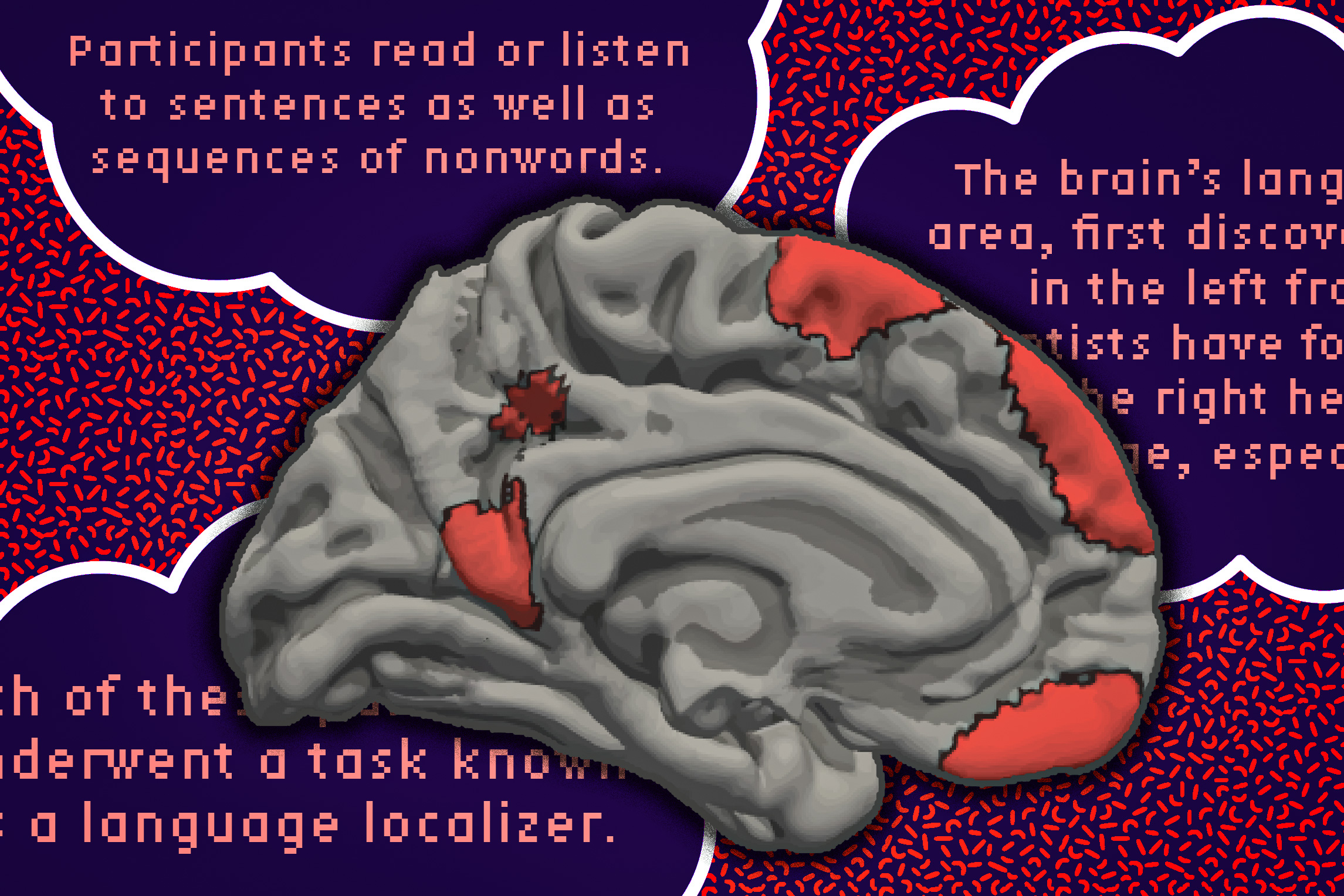 The Brain's Language Network: Beyond the Left Hemisphere (2026)