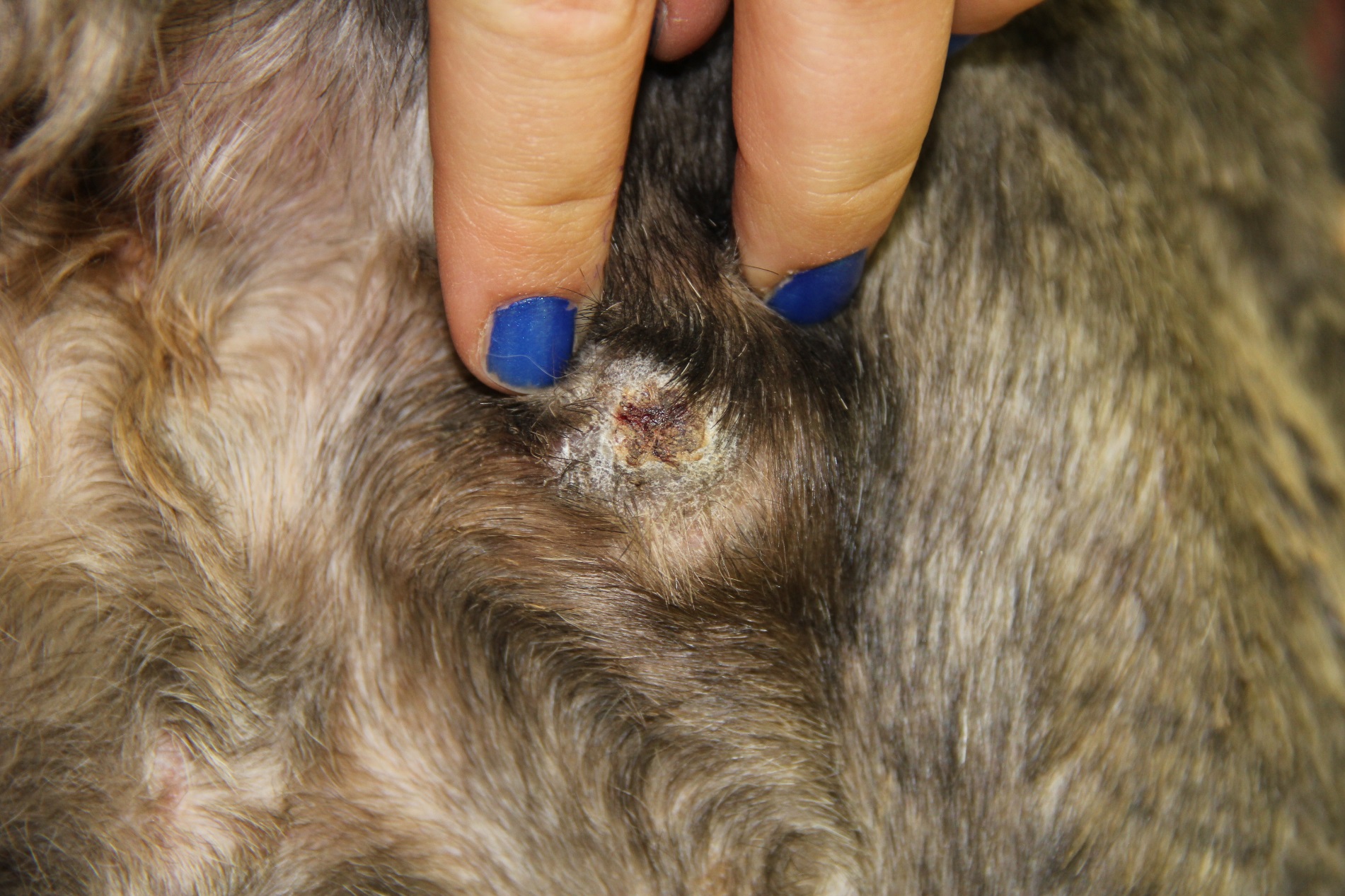 Uw Madison Spinoff Gets Fda Ok For Bacteria Killing Wound Dressing