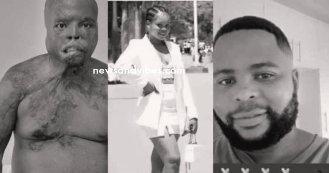 Lady pours acid on boyfriend over suspected cheating