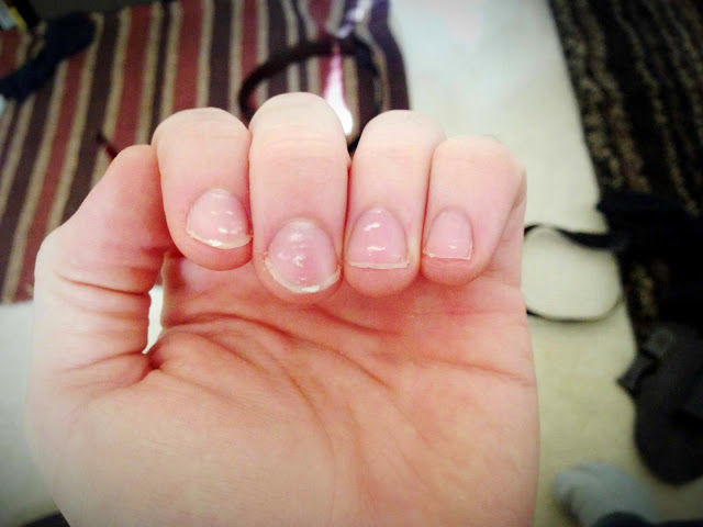 white spots
