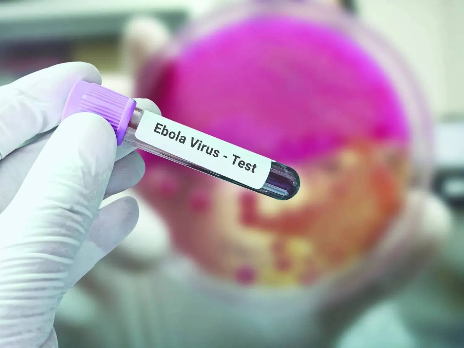 You are currently viewing Breaking: Ebola confirmed in FCT, 44 contacts identified