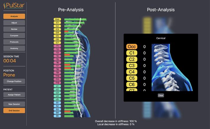 Pre analysis data