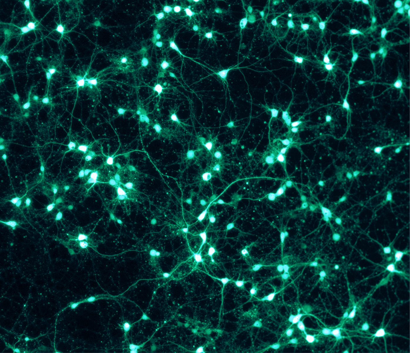 Brain Rejuvenation: The Ultimate Anti-Aging Challenge (2026)