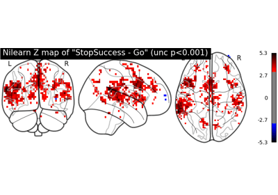 Plotting Brain Images Nilearn - Download Perfect Abstract Texture | Retina